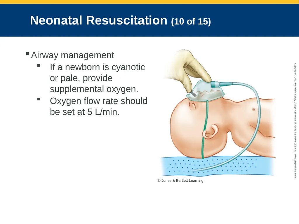 Obstetrics and Neonatal Care CHAPTER 35: Focused - slide 114 of 126