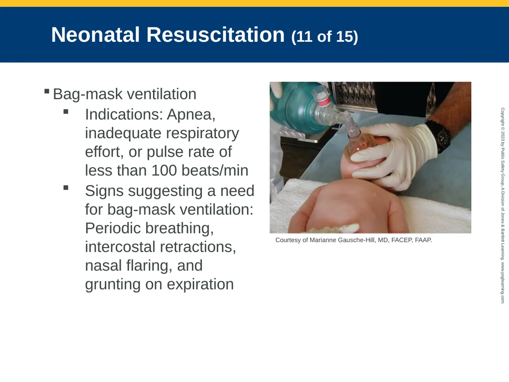 Obstetrics and Neonatal Care CHAPTER 35: Focused - slide 115 of 126