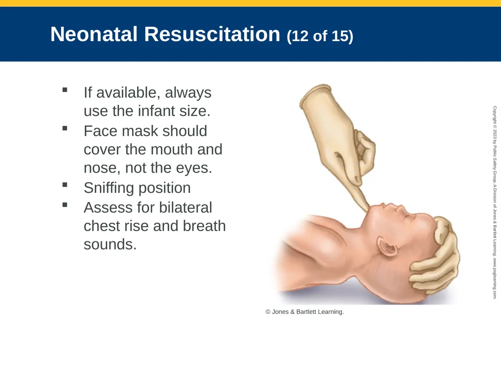 Obstetrics and Neonatal Care CHAPTER 35: Focused - slide 116 of 126