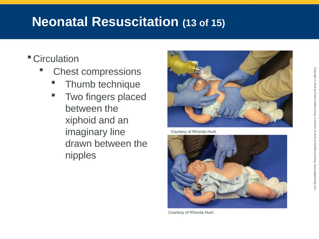 Obstetrics and Neonatal Care CHAPTER 35: Focused - slide 117 of 126