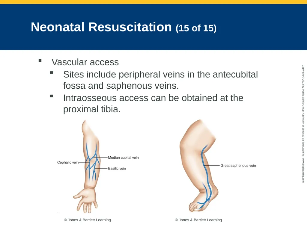 Obstetrics and Neonatal Care CHAPTER 35: Focused - slide 119 of 126