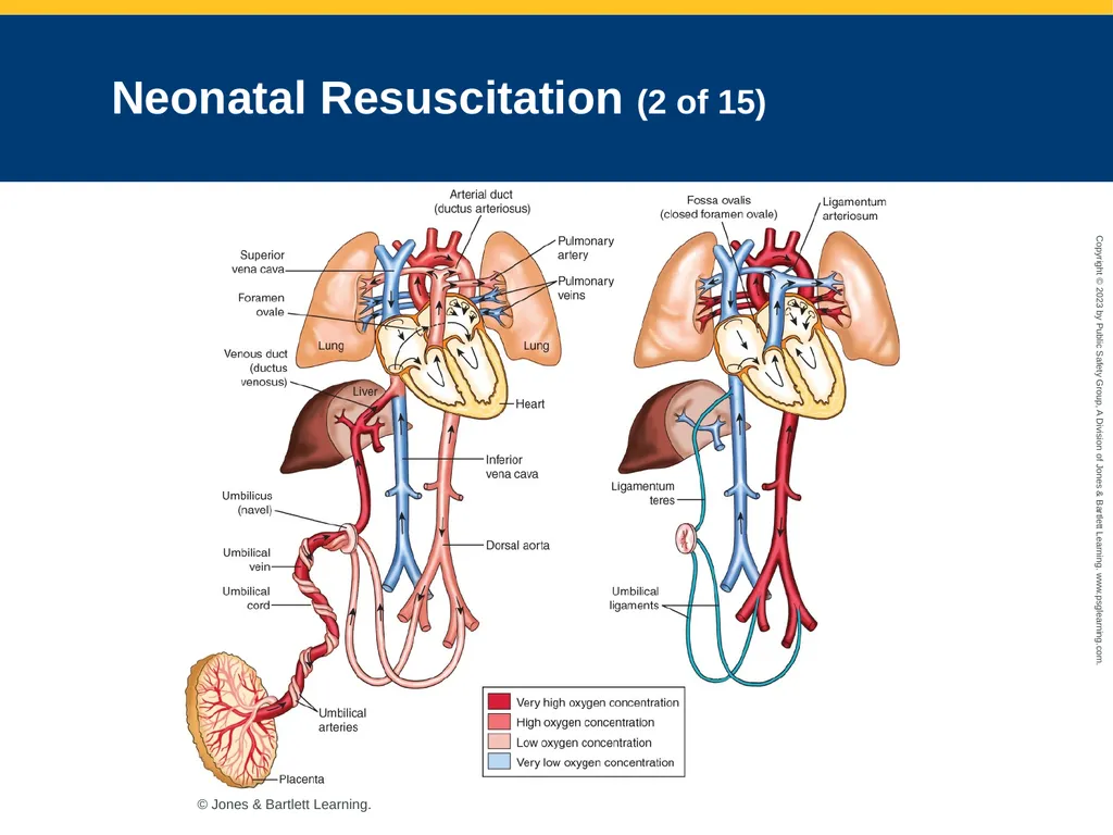 Obstetrics and Neonatal Care CHAPTER 35: Focused - slide 106 of 126
