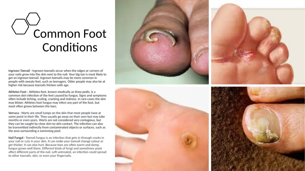 Manicure & Pedicure Introduction Manicure & - slide 20 of 40