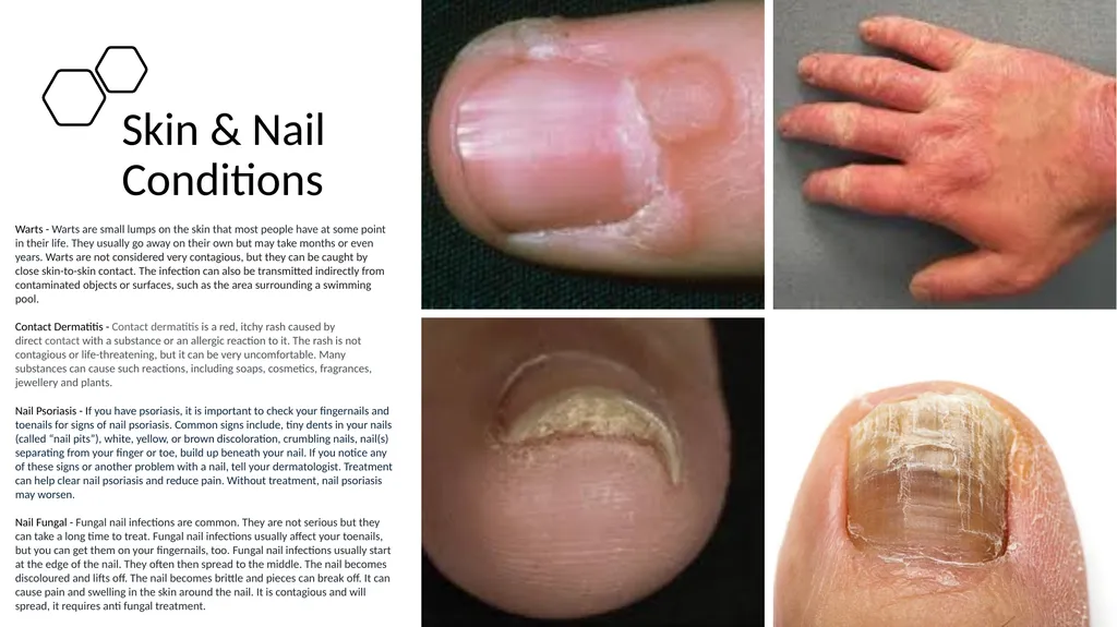 Manicure & Pedicure Introduction Manicure & - slide 17 of 40