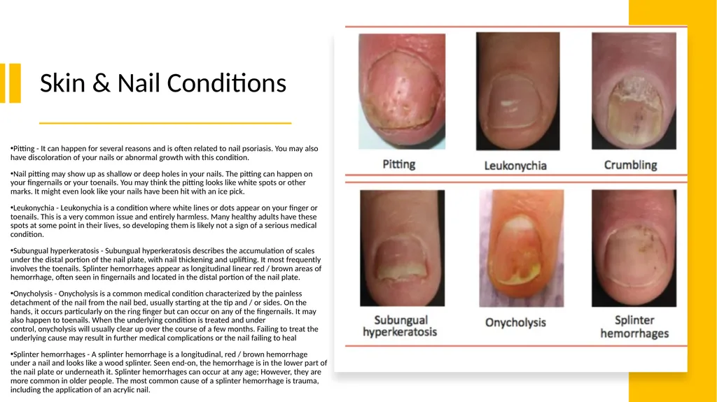 Manicure & Pedicure Introduction Manicure & - slide 18 of 40
