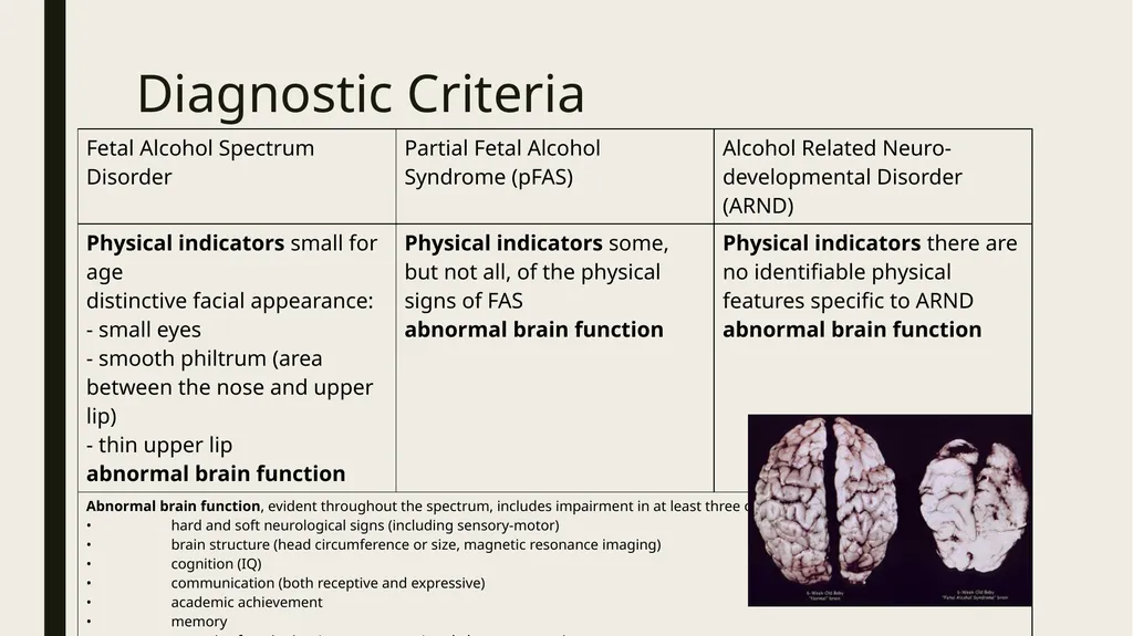 FASD Fetal Alcohol Spectrum Disorder Jennifer - slide 4 of 29
