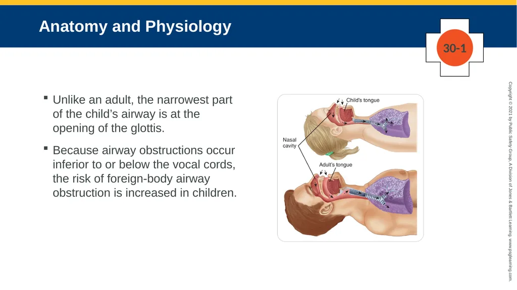 CHAPTER 30 Pediatric Emergencies The following - slide 14 of 105