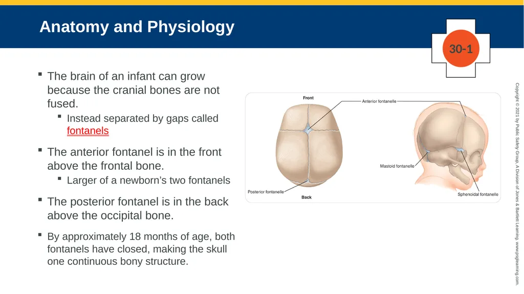 CHAPTER 30 Pediatric Emergencies The following - slide 17 of 105