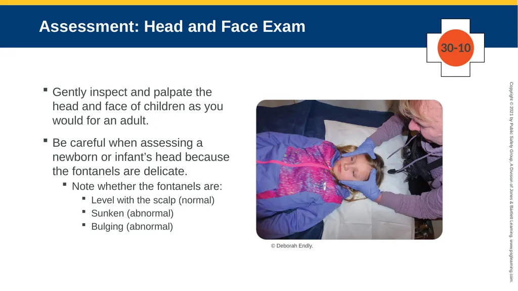 CHAPTER 30 Pediatric Emergencies The following - slide 90 of 105
