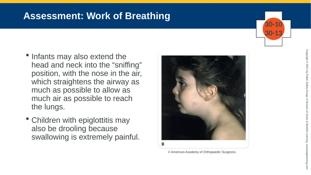 CHAPTER 30 Pediatric Emergencies The following - slide 61 of 105