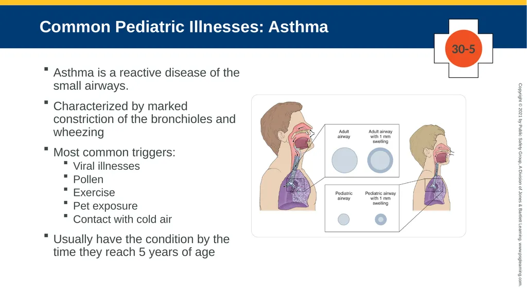 CHAPTER 30 Pediatric Emergencies The following - slide 35 of 105