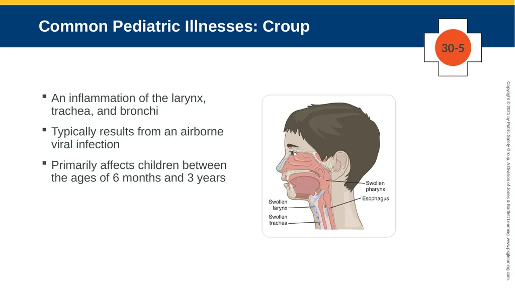 CHAPTER 30 Pediatric Emergencies The following - slide 29 of 105