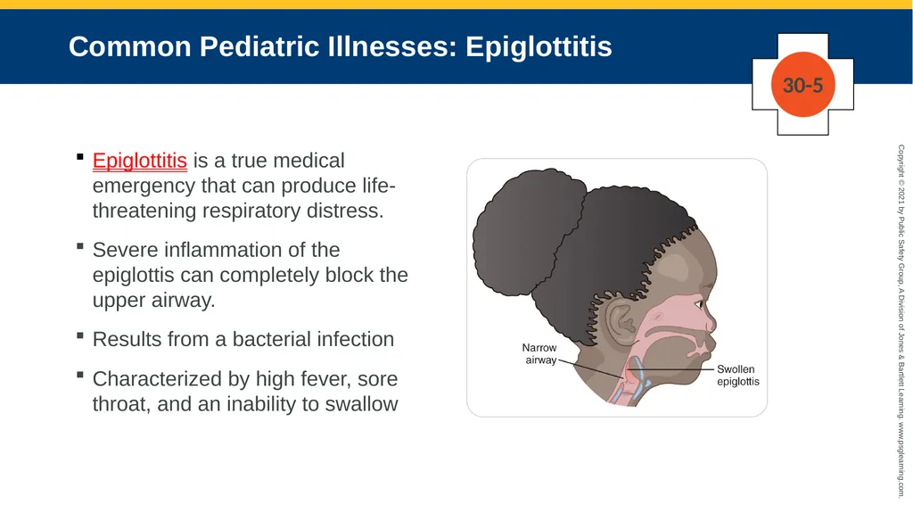 CHAPTER 30 Pediatric Emergencies The following - slide 36 of 105