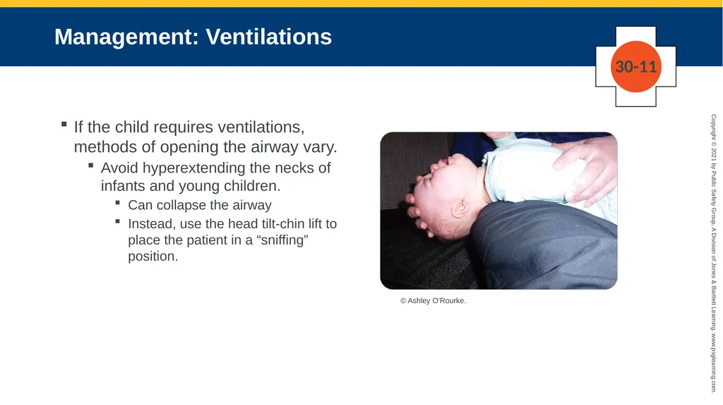 CHAPTER 30 Pediatric Emergencies The following - slide 97 of 105