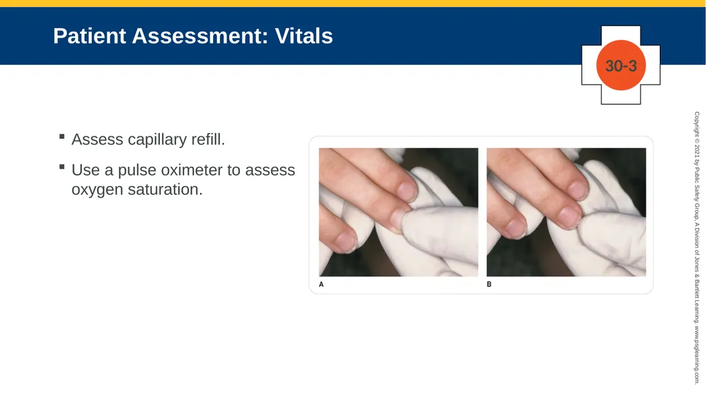 CHAPTER 30 Pediatric Emergencies The following - slide 83 of 105