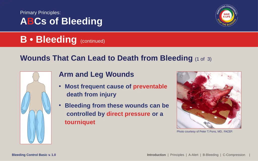 Bleeding Control (B-Con) Basic Copyright © 2017 by - slide 12 of 61
