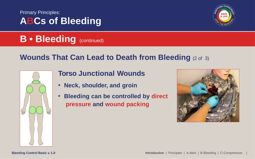 Bleeding Control (B-Con) Basic Copyright © 2017 by - slide 13 of 61
