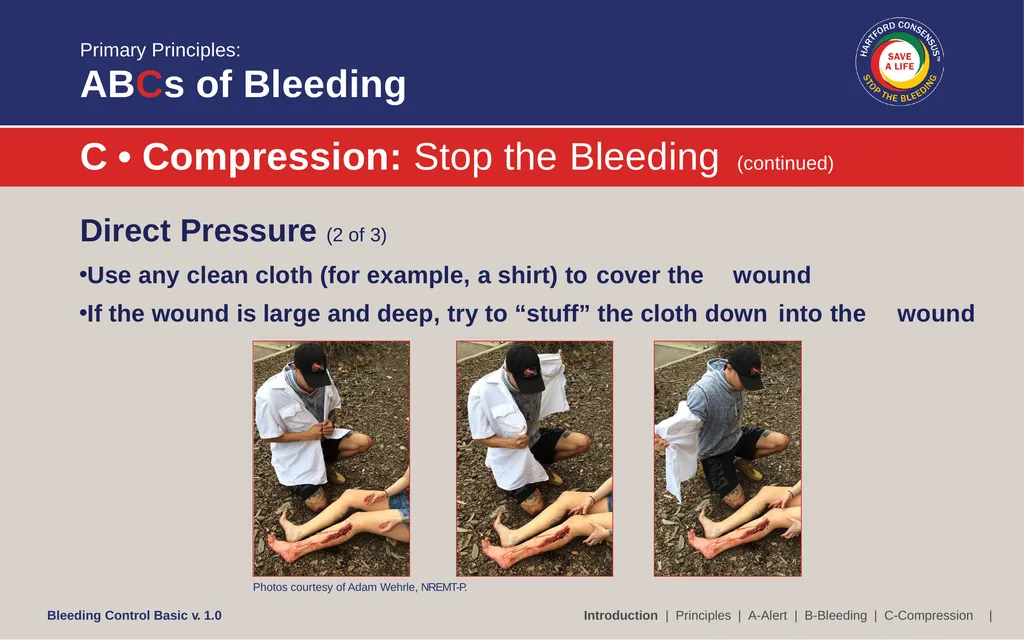 Bleeding Control (B-Con) Basic Copyright © 2017 by - slide 19 of 61