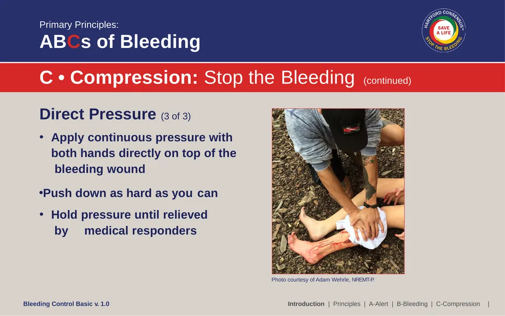 Bleeding Control (B-Con) Basic Copyright © 2017 by - slide 20 of 61