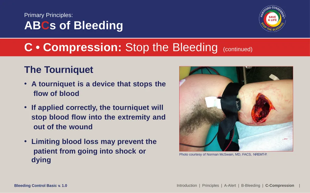 Bleeding Control (B-Con) Basic Copyright © 2017 by - slide 26 of 61