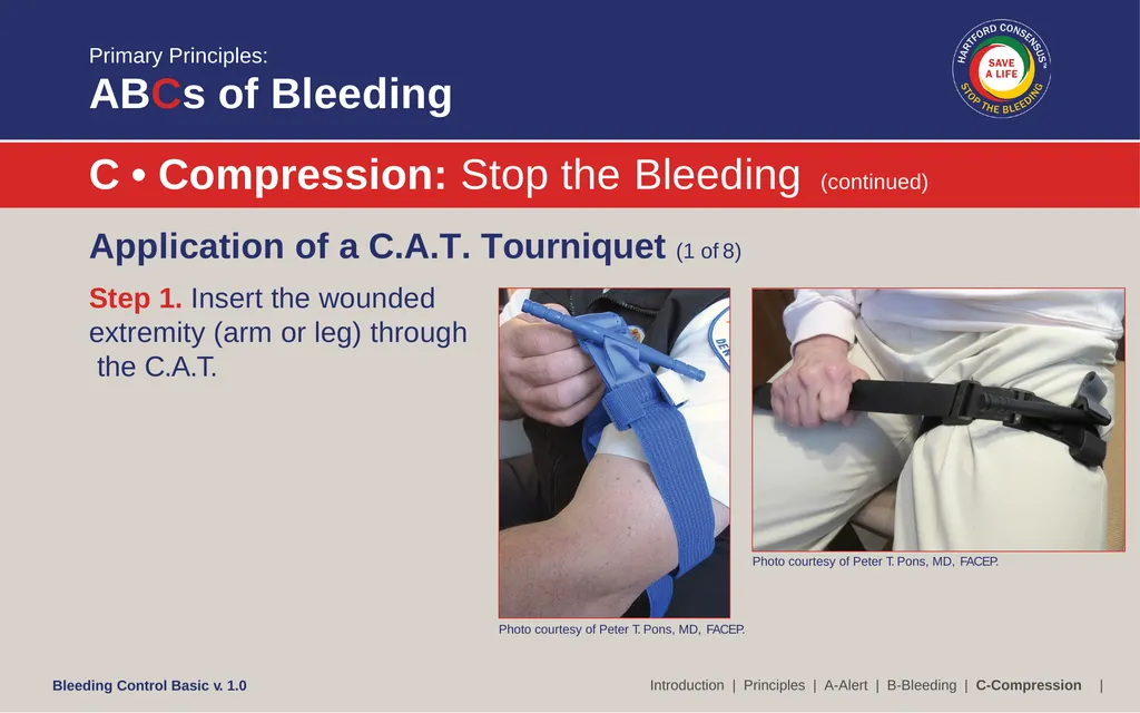 Bleeding Control (B-Con) Basic Copyright © 2017 by - slide 30 of 61