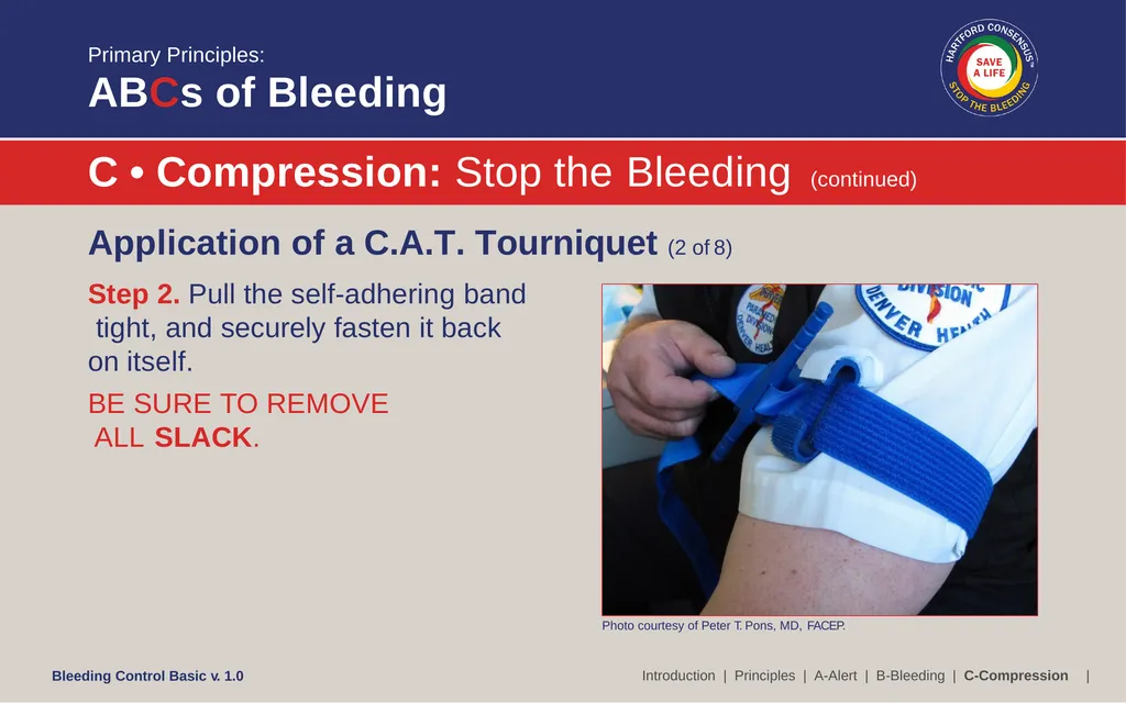 Bleeding Control (B-Con) Basic Copyright © 2017 by - slide 31 of 61