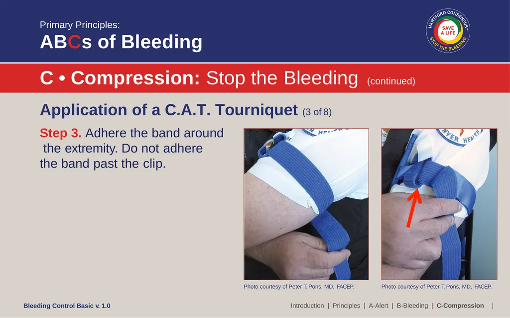 Bleeding Control (B-Con) Basic Copyright © 2017 by - slide 32 of 61
