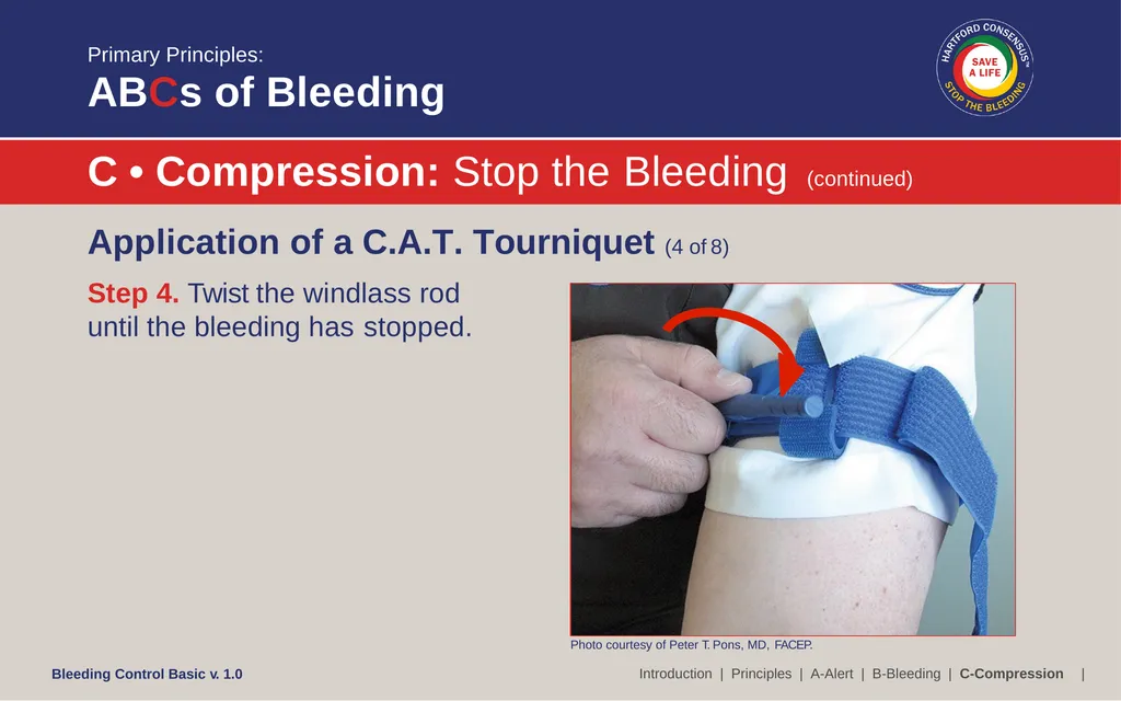 Bleeding Control (B-Con) Basic Copyright © 2017 by - slide 33 of 61