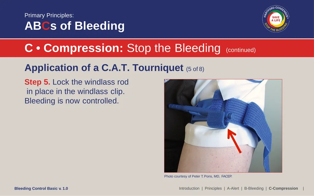 Bleeding Control (B-Con) Basic Copyright © 2017 by - slide 34 of 61