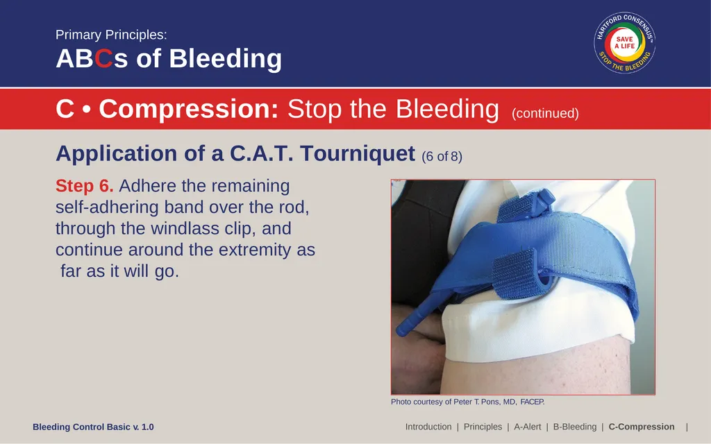 Bleeding Control (B-Con) Basic Copyright © 2017 by - slide 35 of 61