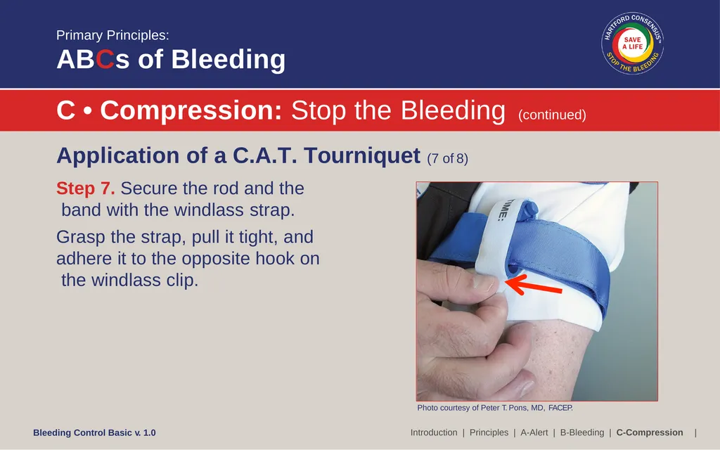 Bleeding Control (B-Con) Basic Copyright © 2017 by - slide 36 of 61