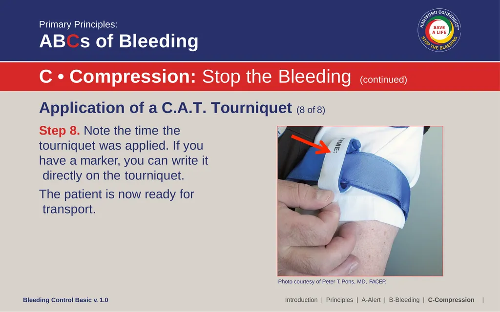 Bleeding Control (B-Con) Basic Copyright © 2017 by - slide 37 of 61