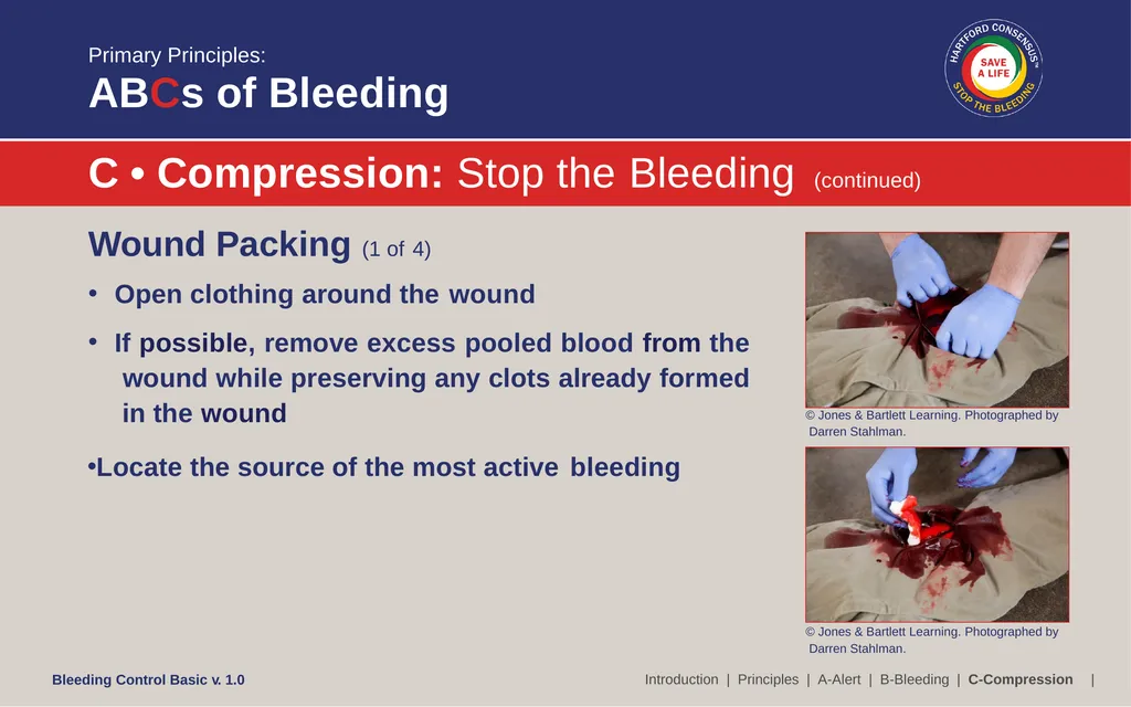 Bleeding Control (B-Con) Basic Copyright © 2017 by - slide 49 of 61