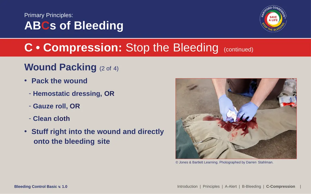 Bleeding Control (B-Con) Basic Copyright © 2017 by - slide 50 of 61