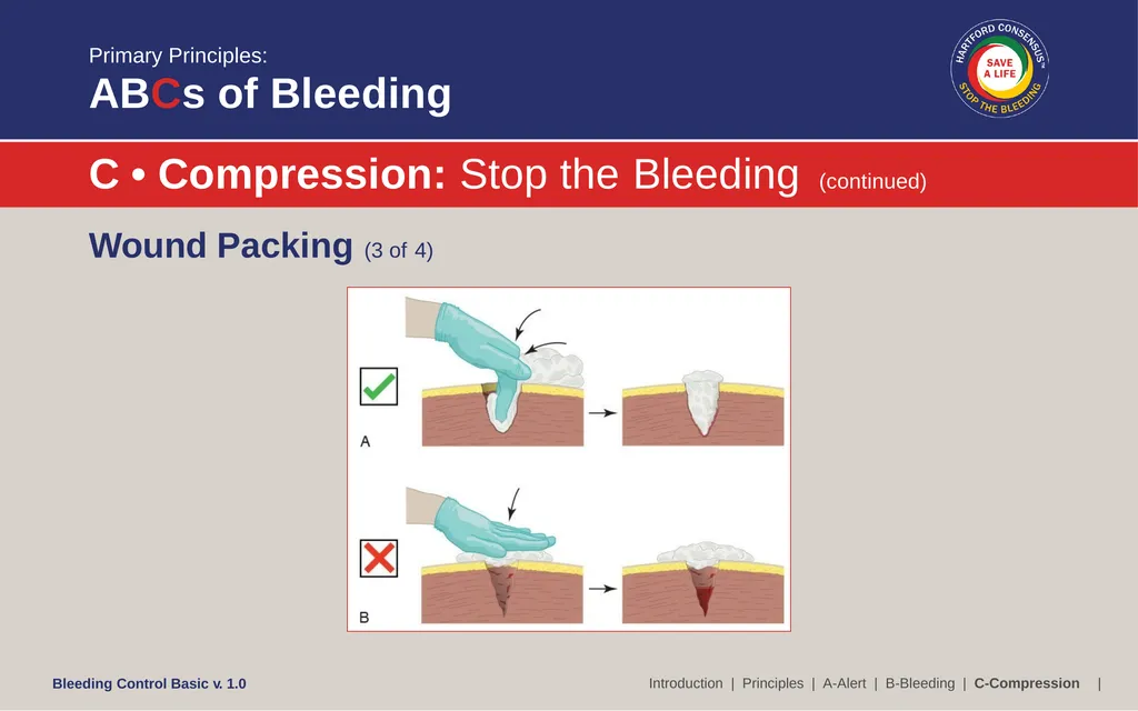 Bleeding Control (B-Con) Basic Copyright © 2017 by - slide 51 of 61