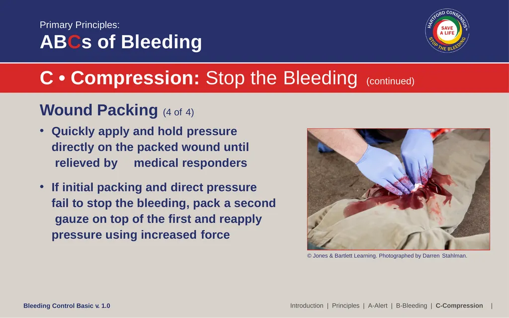 Bleeding Control (B-Con) Basic Copyright © 2017 by - slide 52 of 61