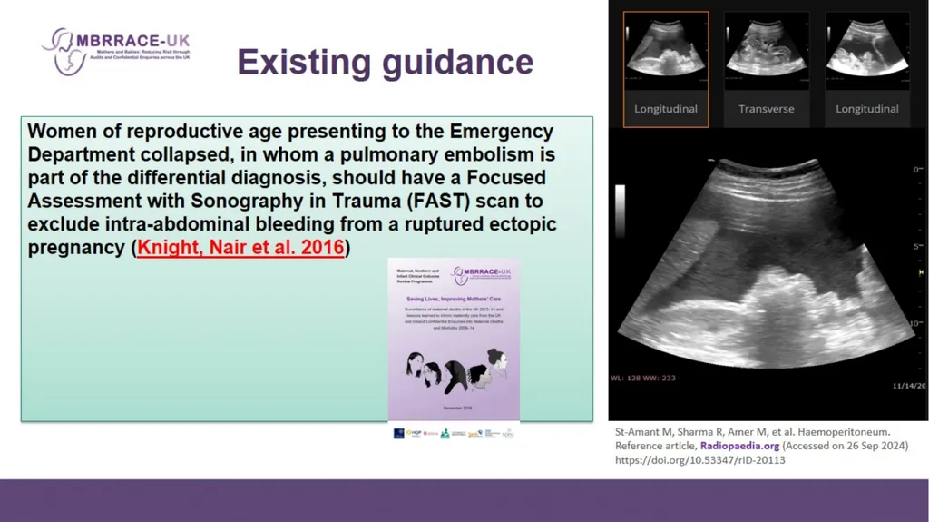 Vignette Vignette Variation in management of - slide 18 of 19
