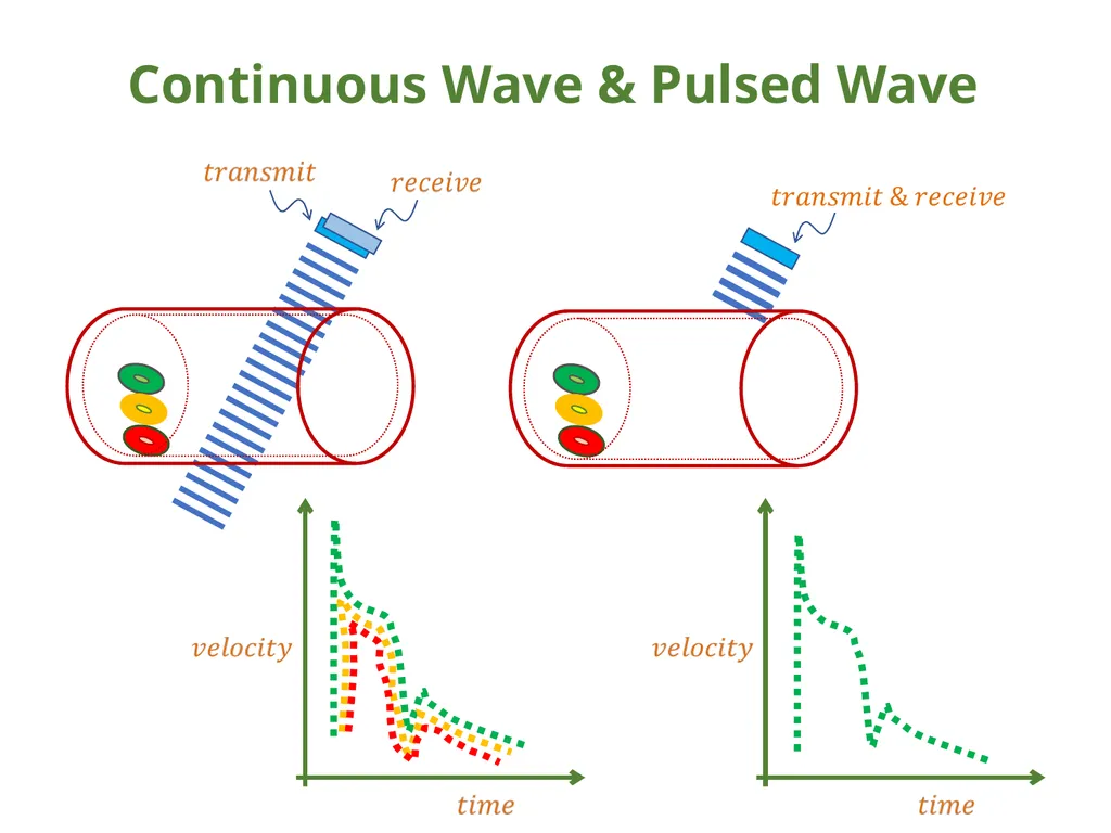 IVC Collapse Physiology knowing the caveats & - slide 21 of 33