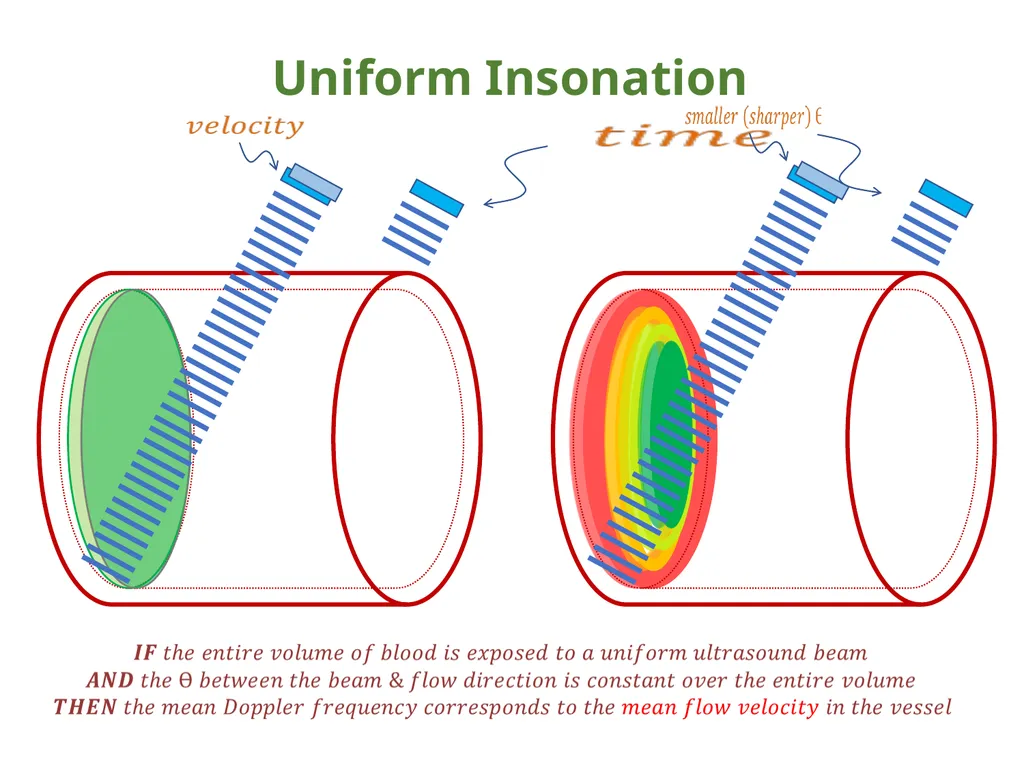 IVC Collapse Physiology knowing the caveats & - slide 29 of 33