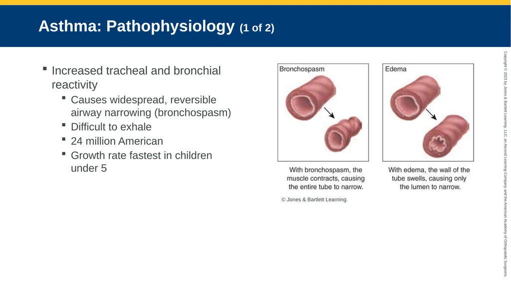 Respiratory Emergencies CHAPTER 17 Introduction - slide 120 of 179