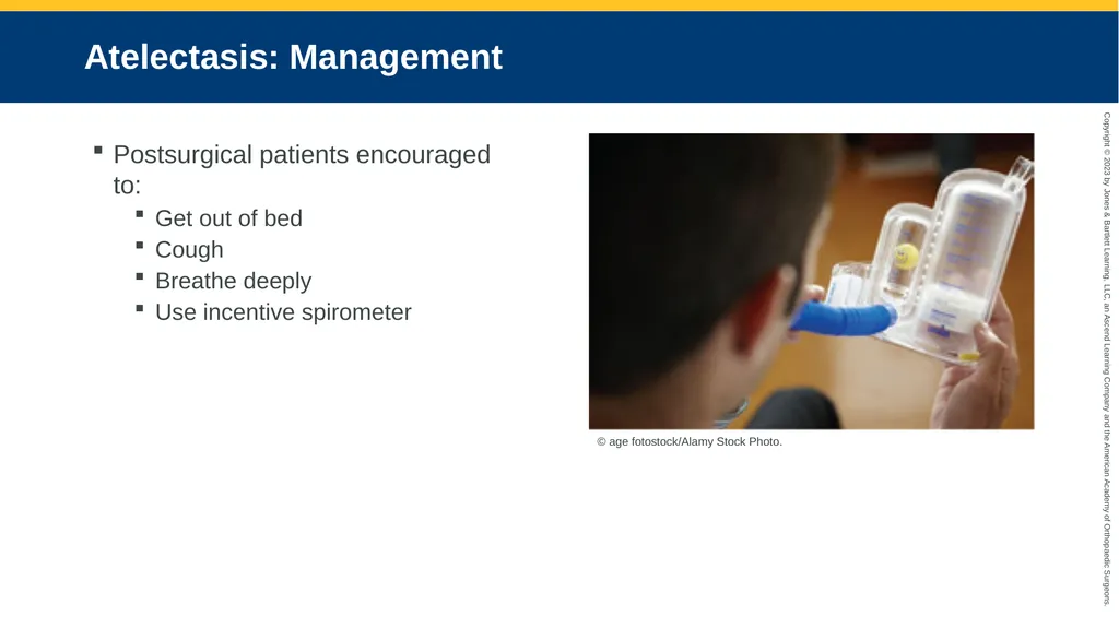 Respiratory Emergencies CHAPTER 17 Introduction - slide 151 of 179
