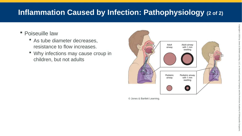 Respiratory Emergencies CHAPTER 17 Introduction - slide 109 of 179