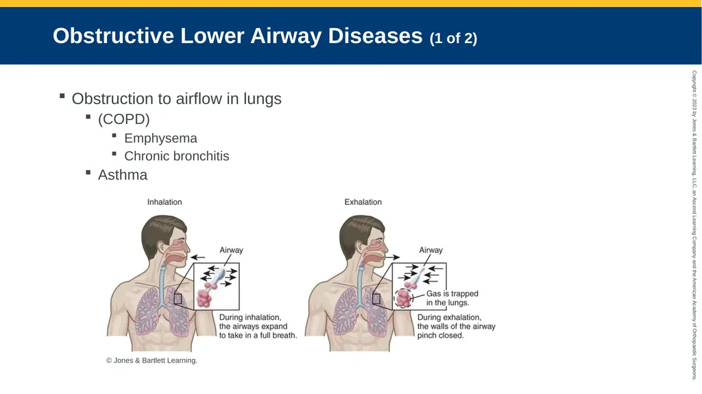 Respiratory Emergencies CHAPTER 17 Introduction - slide 118 of 179
