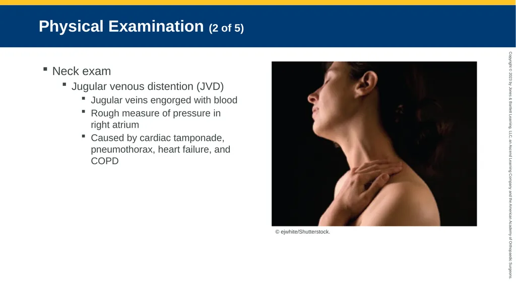 Respiratory Emergencies CHAPTER 17 Introduction - slide 63 of 179