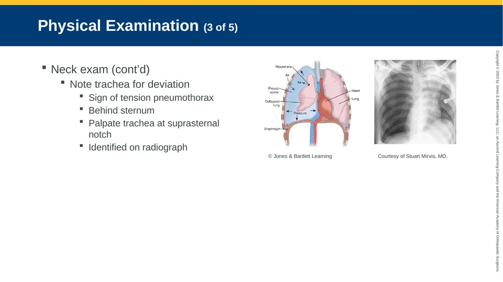 Respiratory Emergencies CHAPTER 17 Introduction - slide 64 of 179