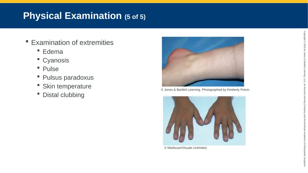 Respiratory Emergencies CHAPTER 17 Introduction - slide 66 of 179