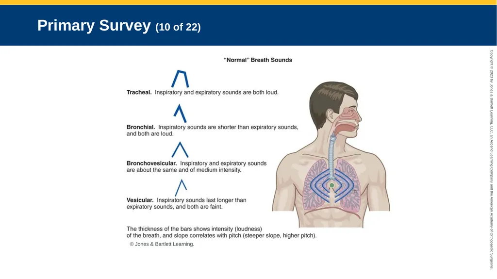 Respiratory Emergencies CHAPTER 17 Introduction - slide 43 of 179