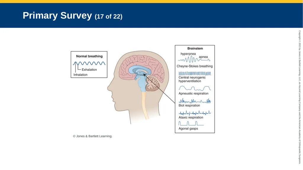 Respiratory Emergencies CHAPTER 17 Introduction - slide 50 of 179