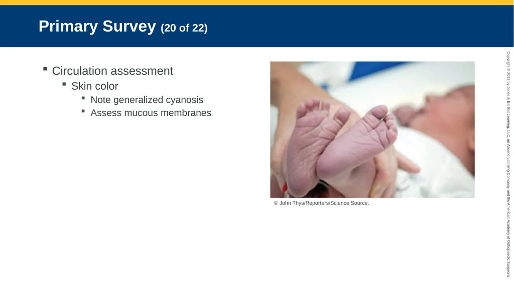 Respiratory Emergencies CHAPTER 17 Introduction - slide 53 of 179