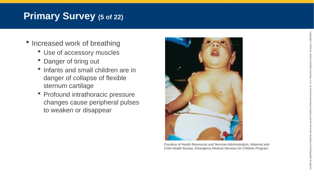Respiratory Emergencies CHAPTER 17 Introduction - slide 38 of 179